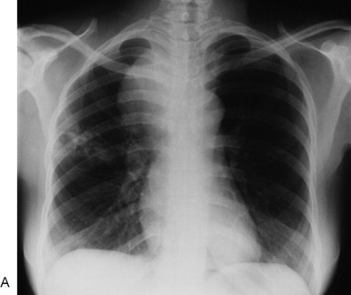Figure 34-17