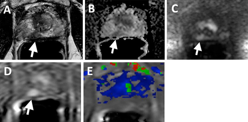 Fig. 6.