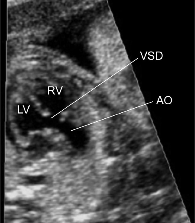 Figure 3(b)