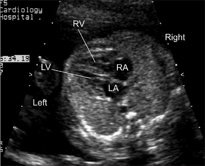 Figure 1(b)