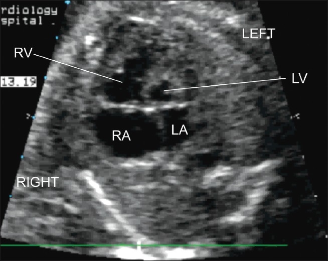 Figure 2(b)