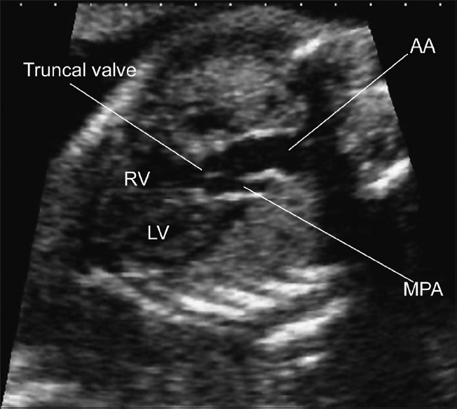 Figure 3(a)