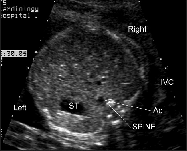 Figure 1(a)