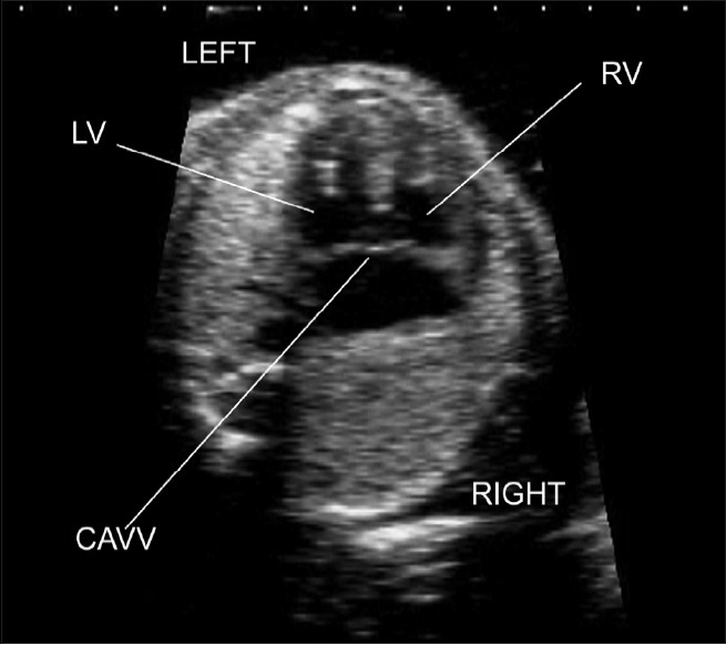 Figure 2(a)