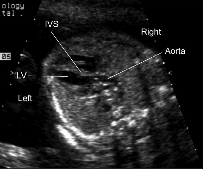 Figure 1(c)