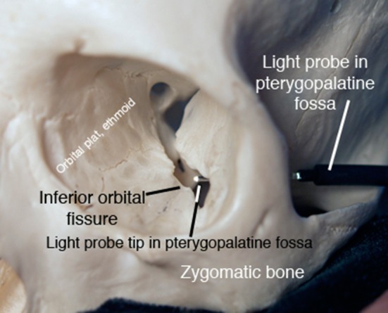 Fig. 2