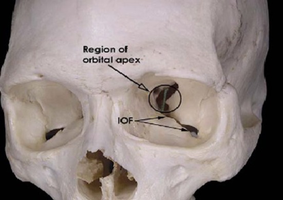Fig. 3