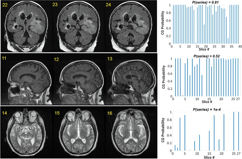 Fig 4.