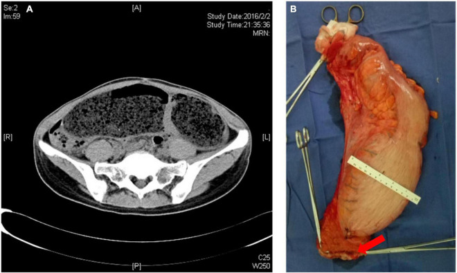 FIGURE 1