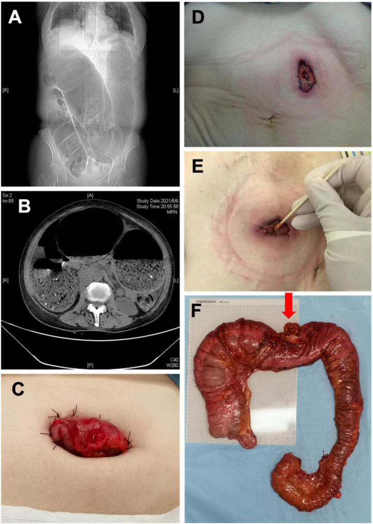 FIGURE 2