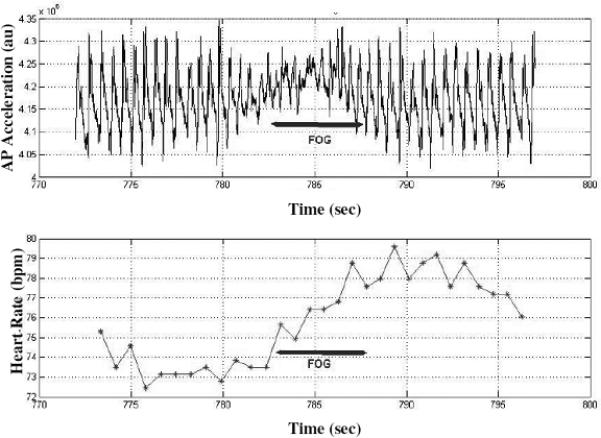 Figure 1a