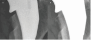 Figure 1A to 1B.