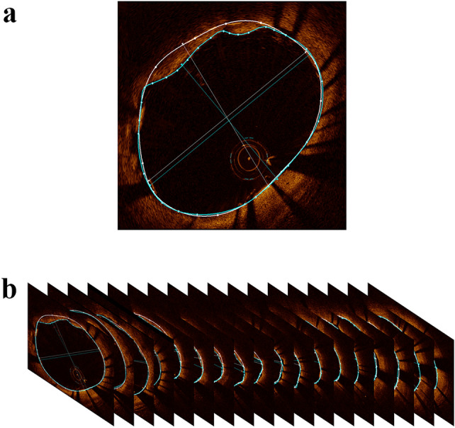 Fig. 1