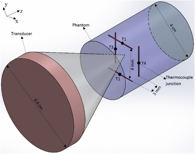 Fig 1