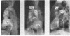 62