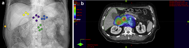 Figure 2