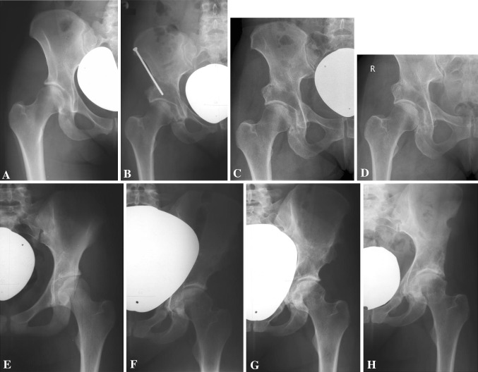 Fig. 1A–H