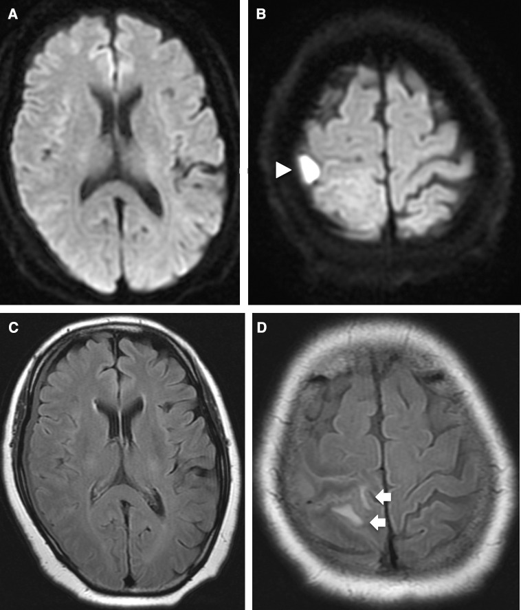 Fig. 1