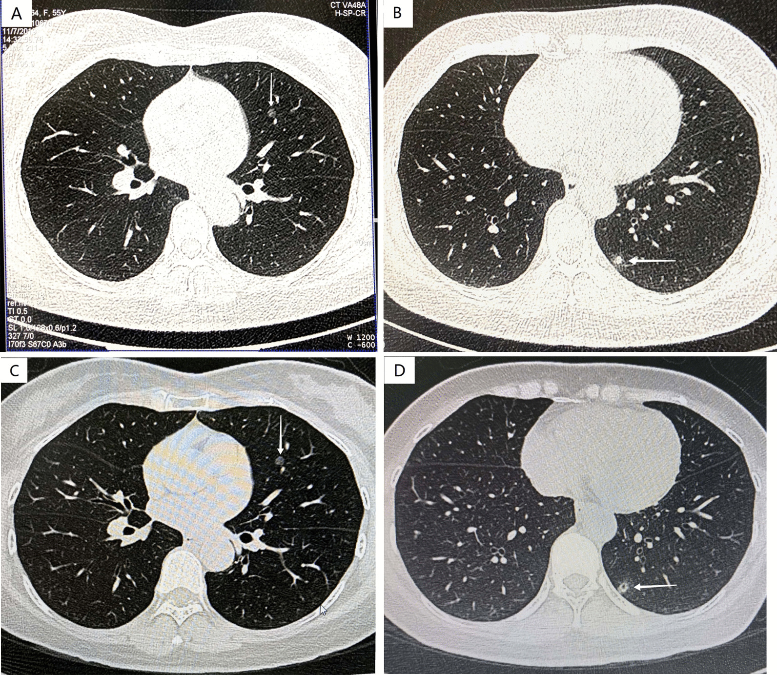 Fig. 1