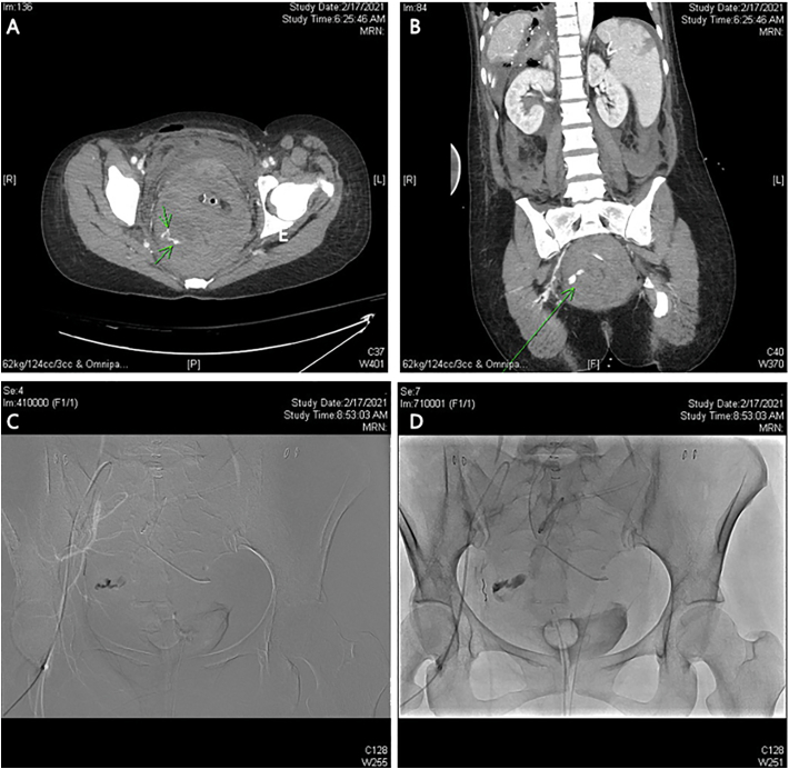 Fig. 2