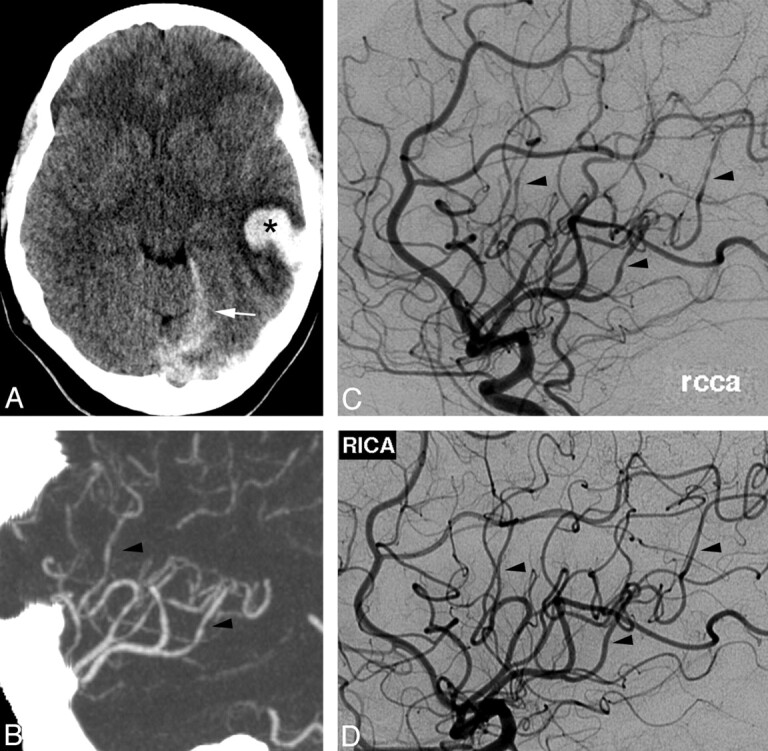 Fig 3.