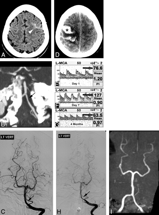 Fig 6.