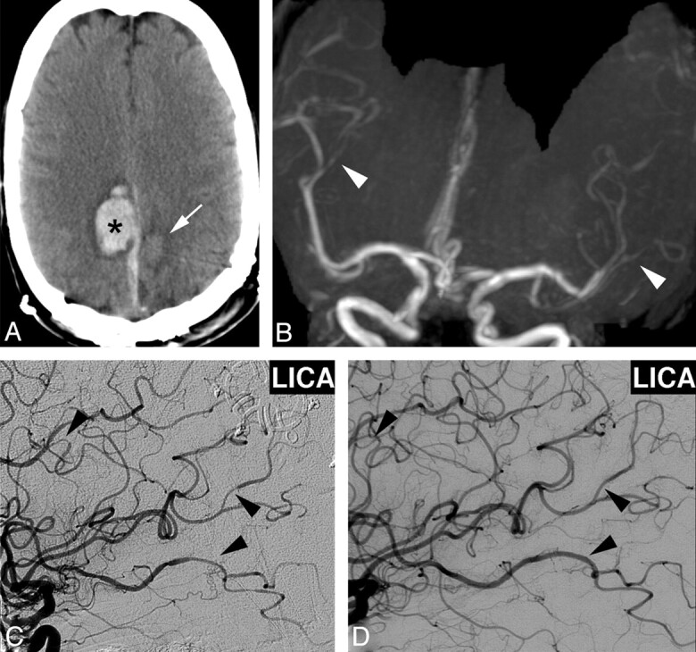 Fig 4.