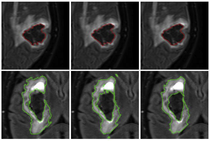 Fig. 12