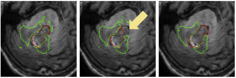 Fig. 15