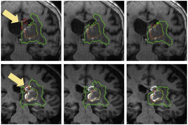 Fig. 14