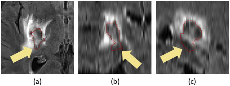 Fig. 10