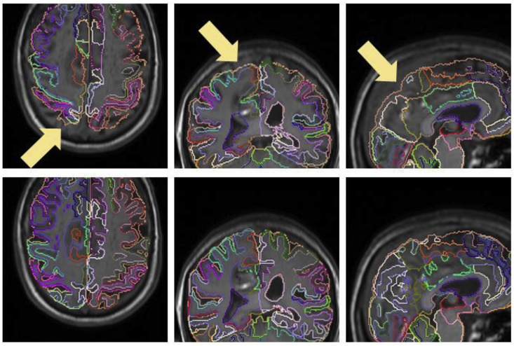 Fig. 13