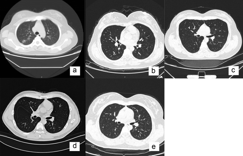 Fig 1