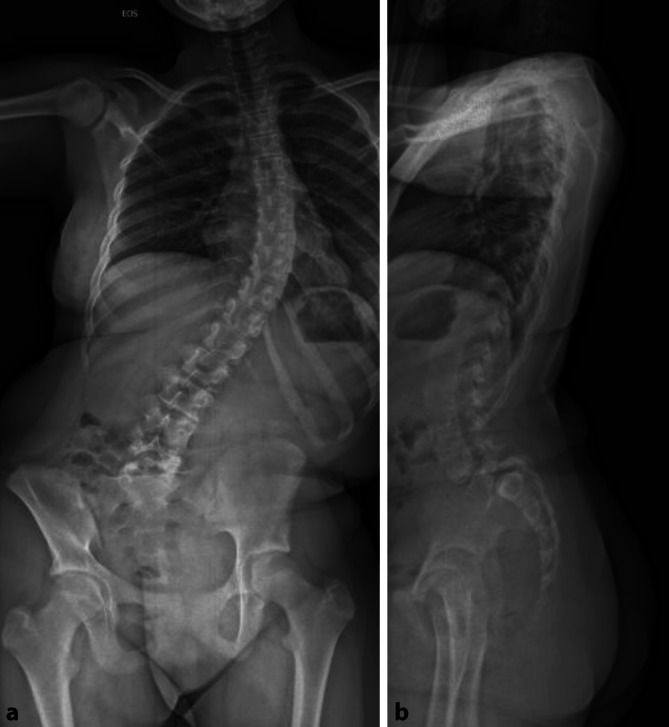 graphic file with name 132_2020_4019_Fig1_HTML.jpg