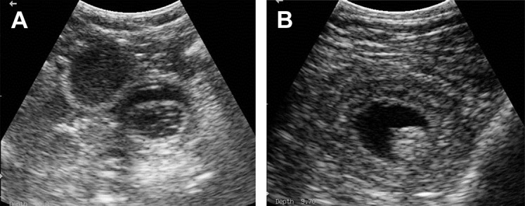 Fig. 17