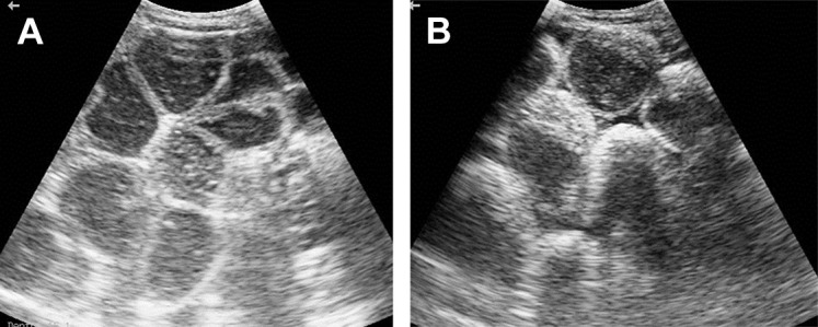 Fig. 16