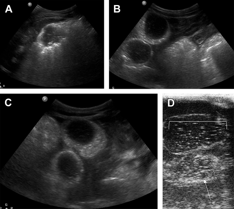 Fig. 18