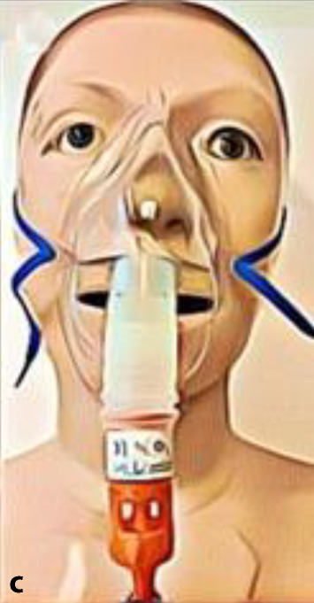 graphic file with name 10405_2022_453_Figd_HTML.jpg