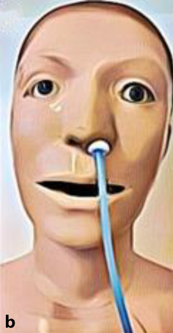 graphic file with name 10405_2022_453_Figc_HTML.jpg