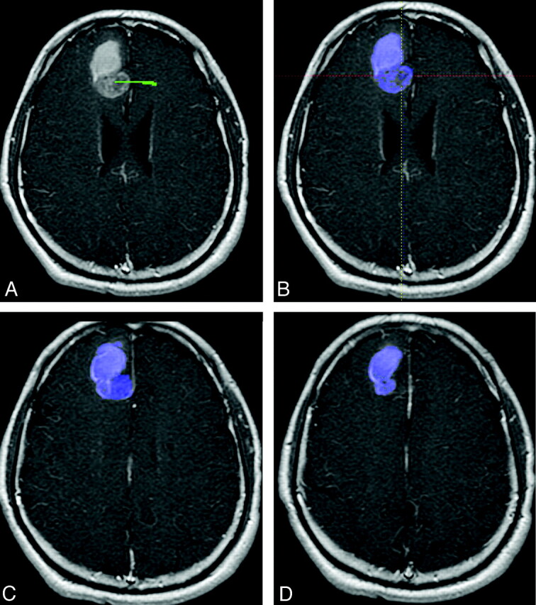 Fig 1.