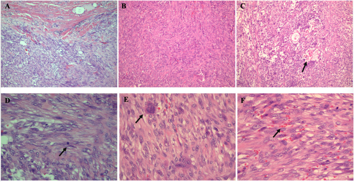 FIGURE 2