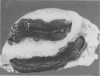 70