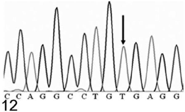 Figure 12