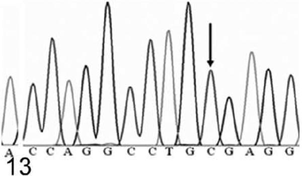 Figure 13