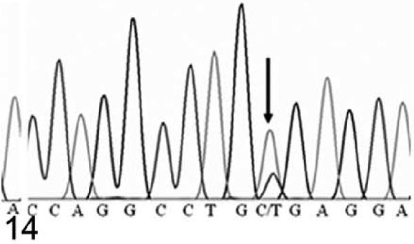 Figure 14