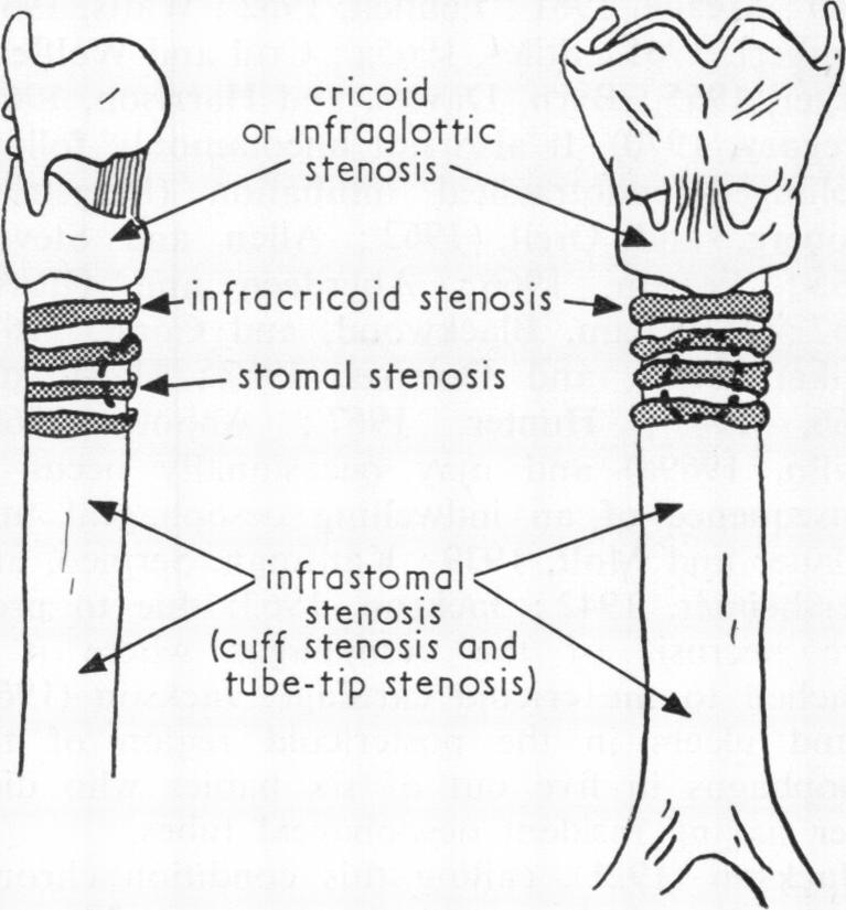 graphic file with name thorax00119-0001-a.jpg