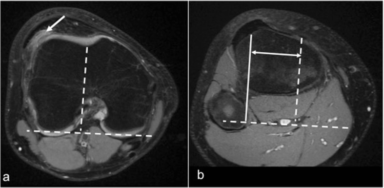 Fig. 5