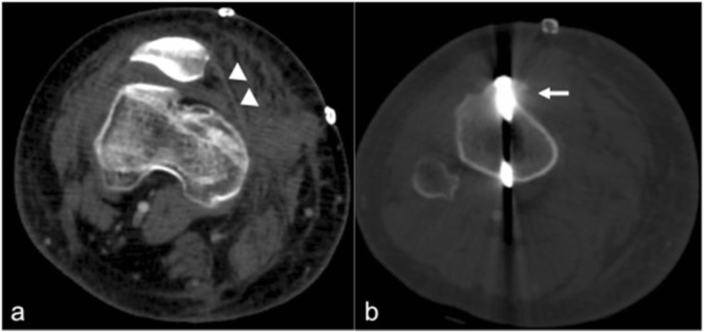 Fig. 9