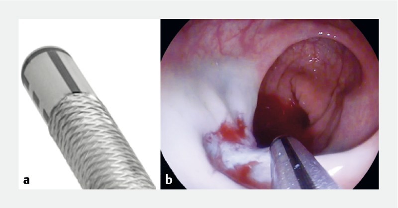 Fig. 2 