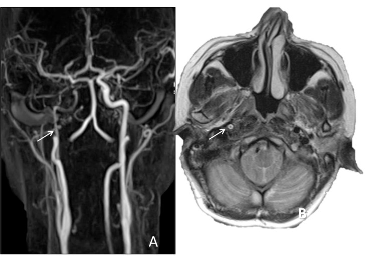 Fig. (6)